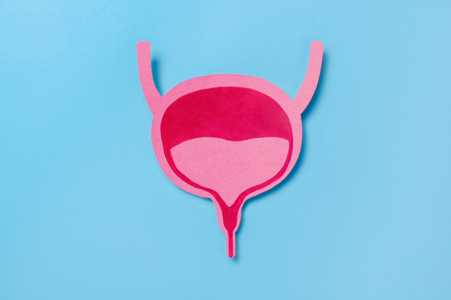 Cystitis